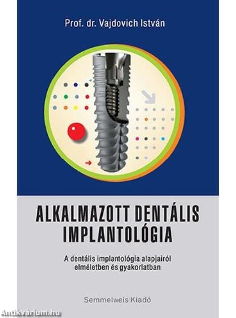 Alkalmazott dentális implantológia