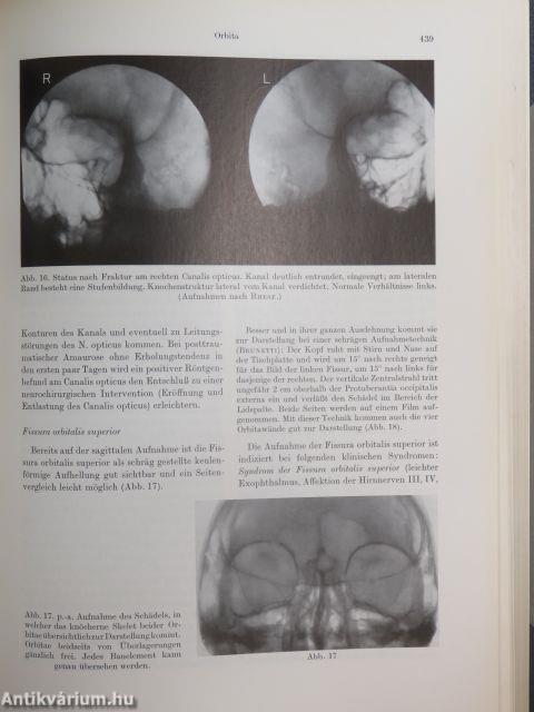 Wirbelsäule, Schädel, Nervensystem, Augen, Schläfenbein, Nasennebenhöhlen, Zähne und Kiefer, Tropische Erkrankungen