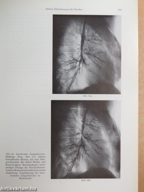 Herz und große Gefäße/Pleura, Mediastinum und Lunge