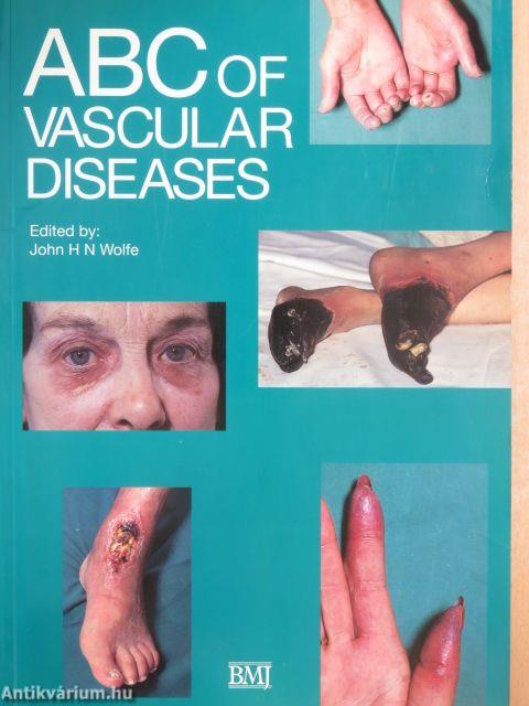 ABC of Vascular Diseases