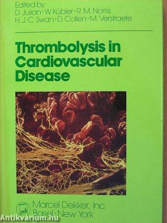 Thrombolysis in Cardiovascular Disease