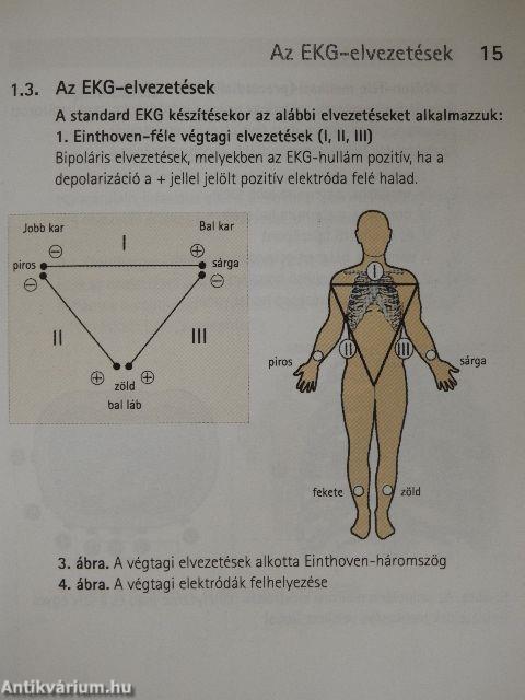 Elektrokardiográfia az orvosi gyakorlatban