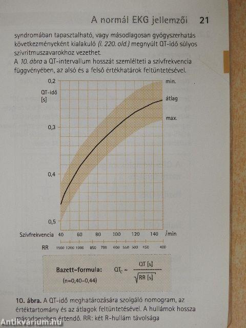 Elektrokardiográfia az orvosi gyakorlatban