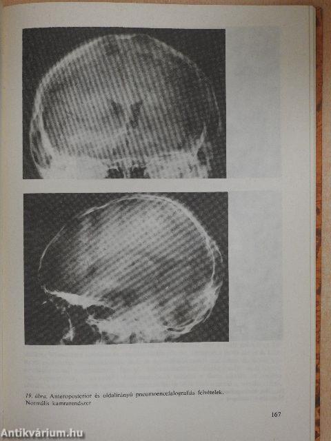 Neurológia, neuropszichológia