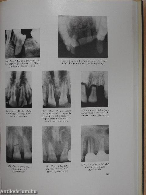 Fogászati röntgenologia