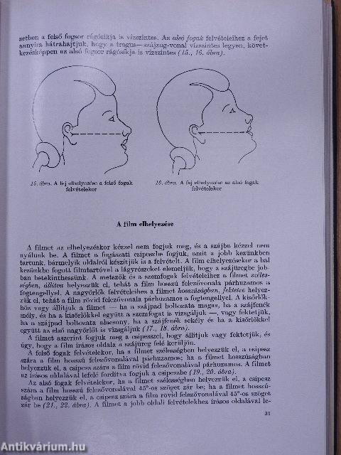 Fogászati röntgenologia