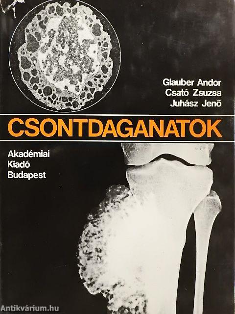 Csontdaganatok