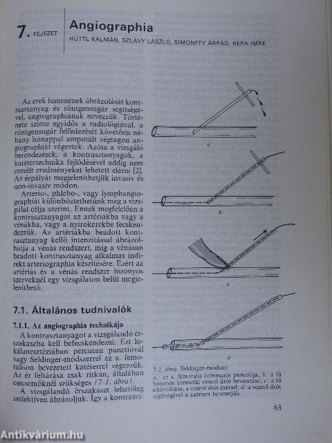 Angiológia