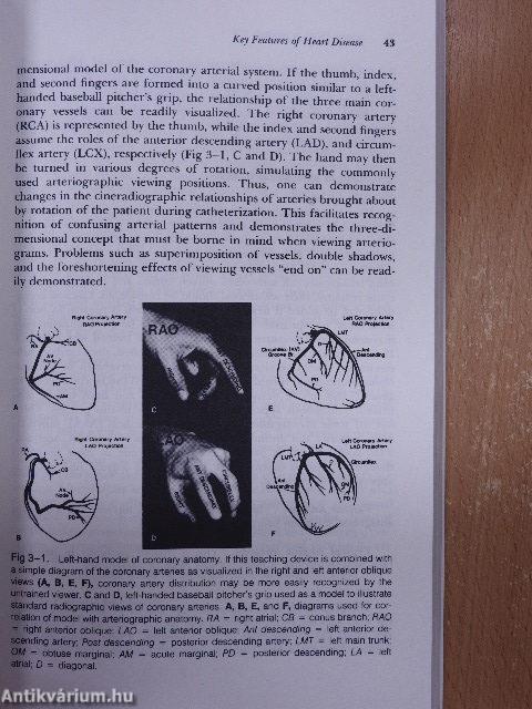 Cardiac Disease