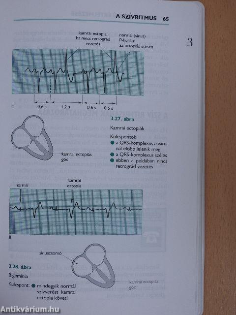 Az EKG helyes értelmezése