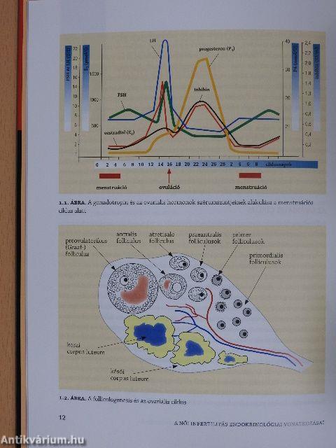 A női infertilitás endokrinológiai vonatkozásai 