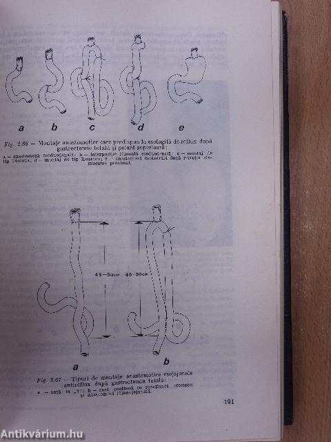 Tratat de Patologie Chirurgicala VI.