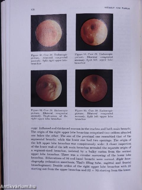 Pediatric Bronchology