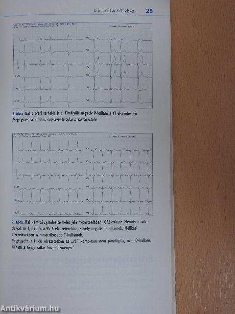 Hypertonia és szövődményei a napi gyakorlatban 