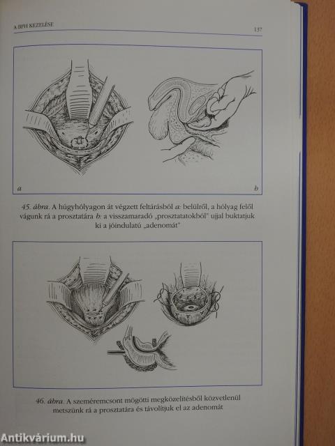 A prosztata betegségei (dedikált példány)