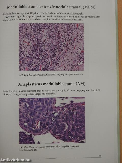 A központi idegrendszer daganatainak pathologiája (kétszeresen dedikált példány)