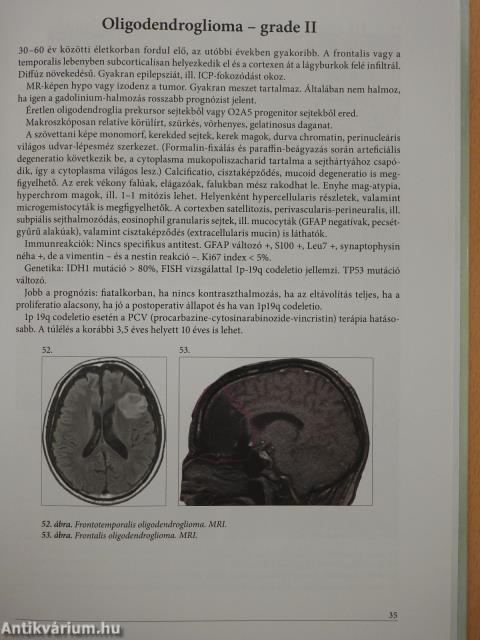 A központi idegrendszer daganatainak pathologiája (kétszeresen dedikált példány)