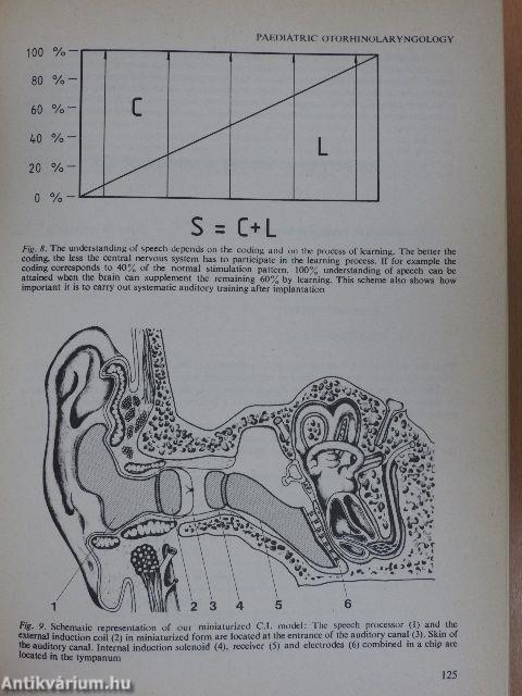 Paediatric Otorhinolaryngology