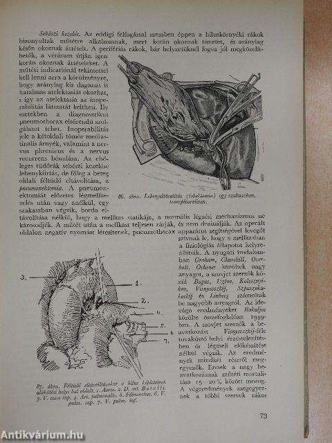 Részletes sebészet