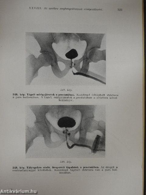 Urologiai röntgendiagnostica