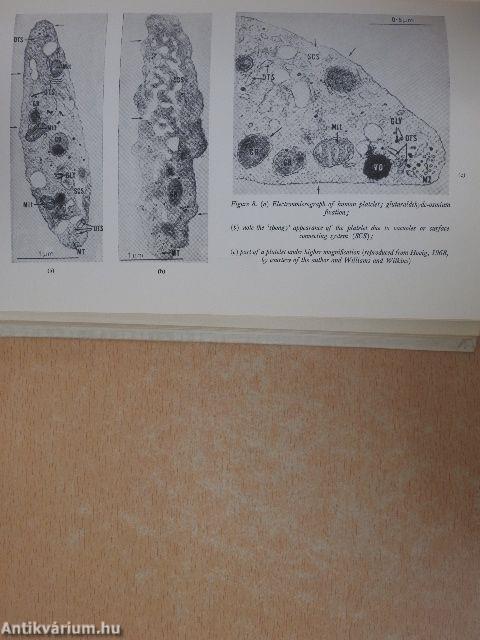 Laboratory Guide to Disordered Haemostasis