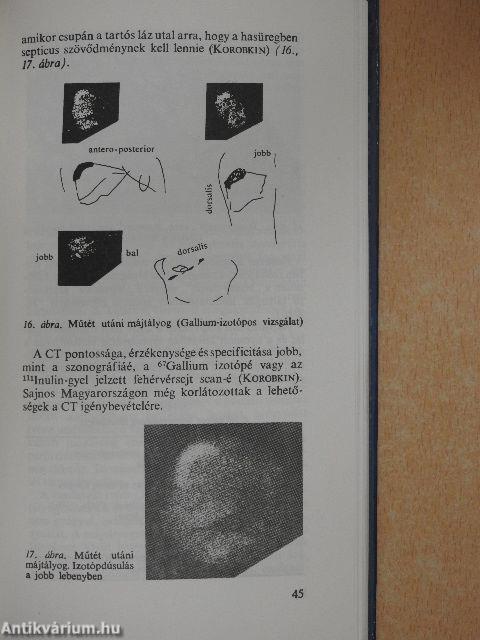 Új lehetőségek a máj és az epeutak sebészetében