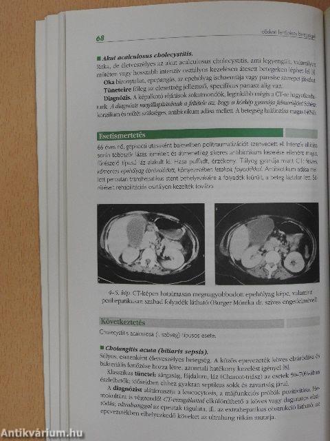 Időskori fertőzések és antibiotikum kezelésük