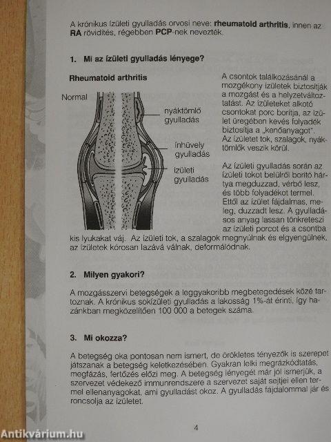 Krónikus sokizületi gyulladás