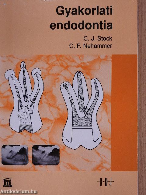 Gyakorlati endodontia