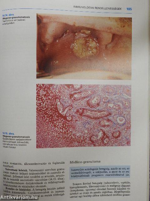 A szájüreg klinikai pathologiája