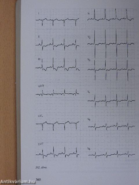 EKG atlasz