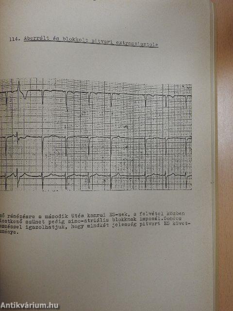 EKG-atlasz