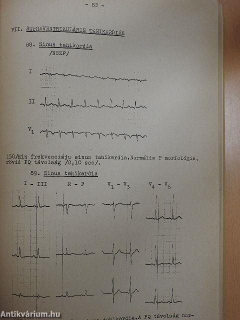 EKG-atlasz