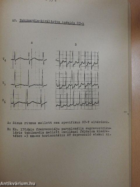 EKG-atlasz