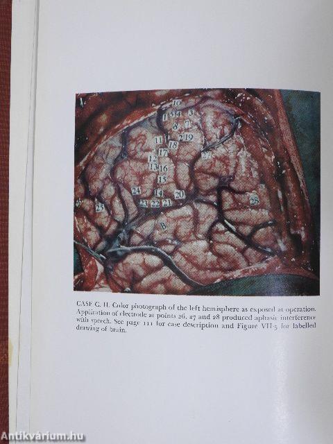 Speech and brain-mechanisms