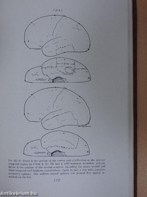 Speech and brain-mechanisms