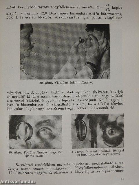 Szemészeti gyakorlatok