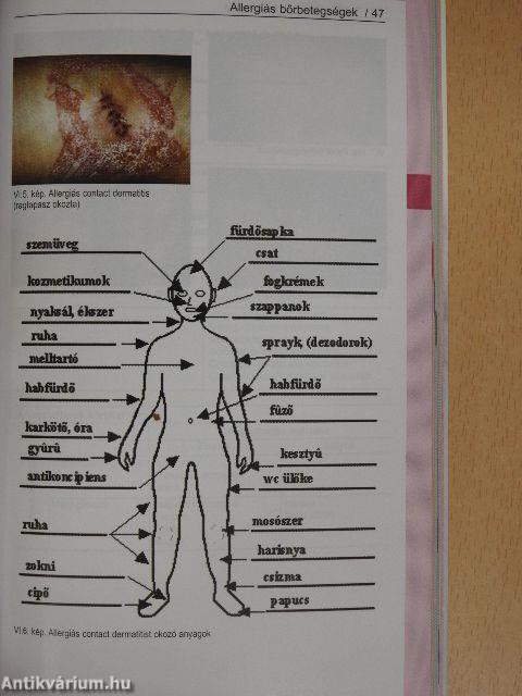 Tabularium dermatologiae