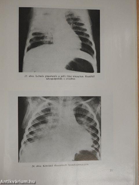 Gyermekgyógyászat és fertőző betegségek