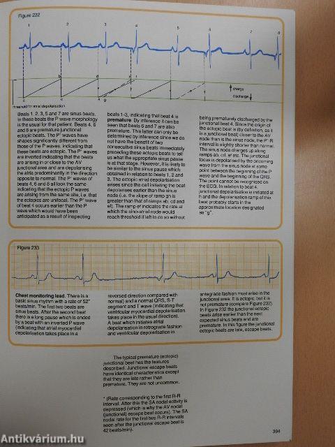 Understanding the Electrocardiogram 3