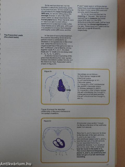 Understanding the Electrocardiogram 1.