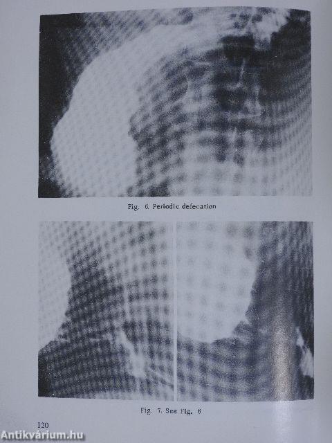 Gastric Precanceroses