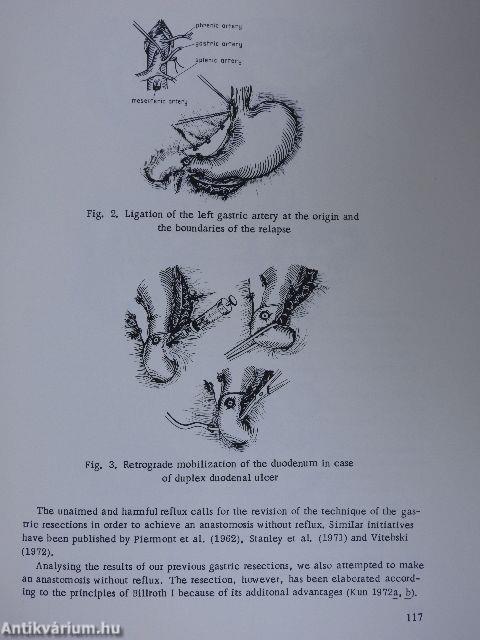 Gastric Precanceroses