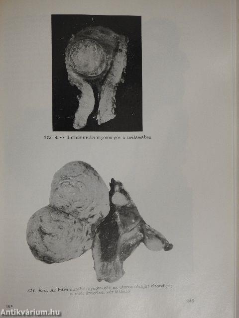 Nőgyógyászati pathologia