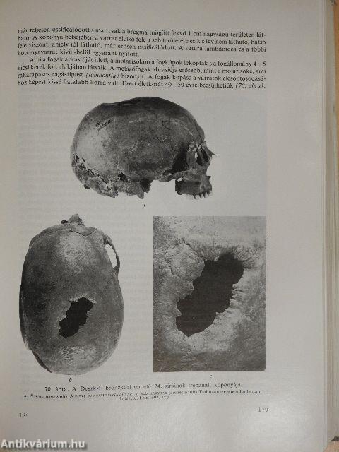 Palaeopathologia III.