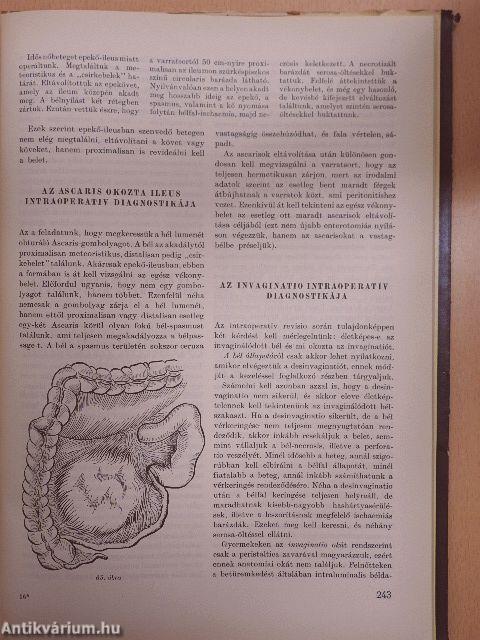 Az acut has sebészete