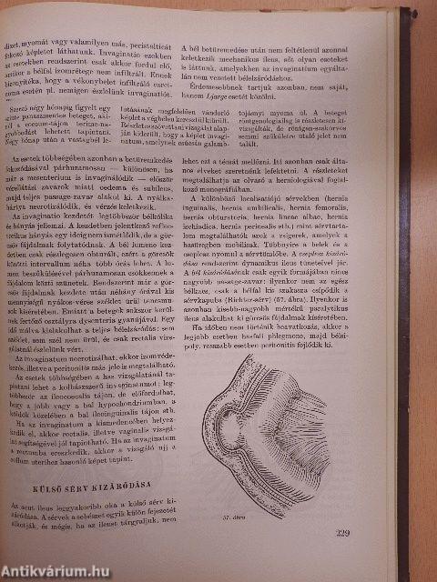 Az acut has sebészete