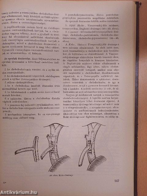 Az acut has sebészete