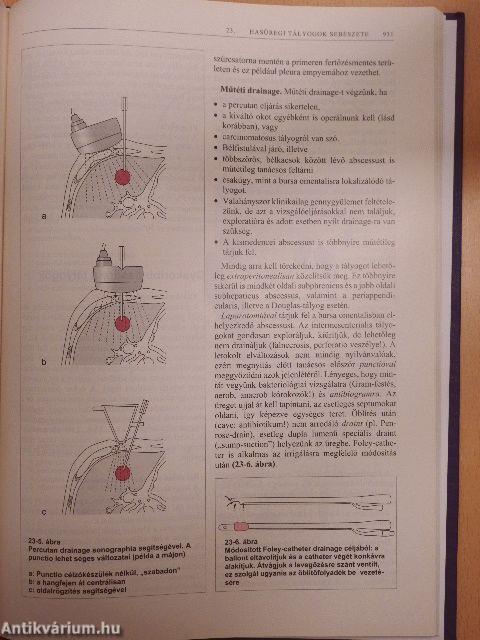 Gastroenterologiai sebészet