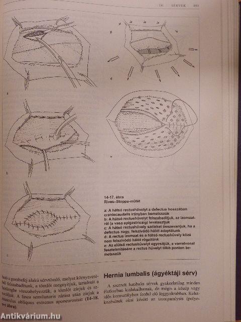 Gastroenterologiai sebészet